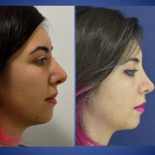 fotos antes y después de nuestros pacientes 4