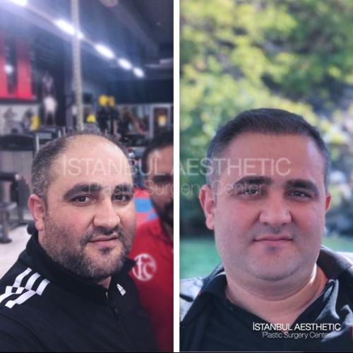 наших пациентов 11