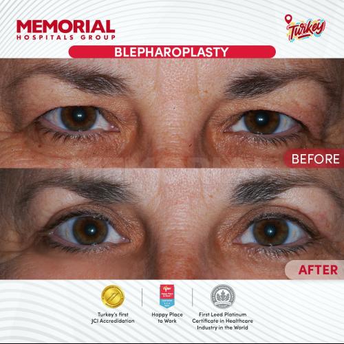 Before after photos of our patients 3