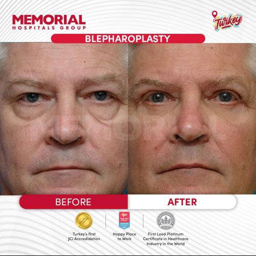 Before after photos of our patients 6