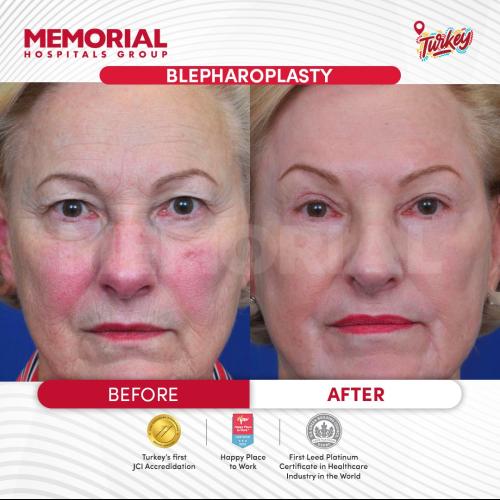 наших пациентов 11