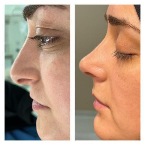 Photos Avant / Après 1