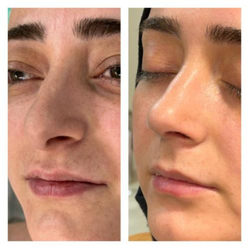 Before after photos of our patients 5