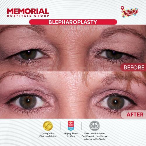 Before after photos of our patients 2