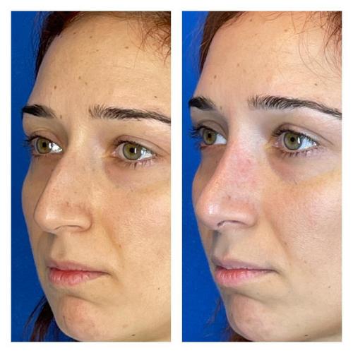 Photos Avant / Après 2