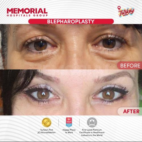 الجراحة التجميلية صور قبل وبعد