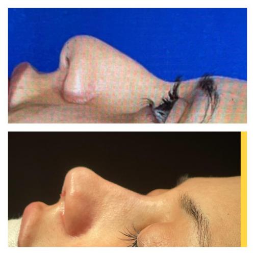 Before after photos of our patients 7