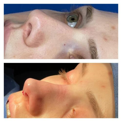 Photos Avant / Après 8