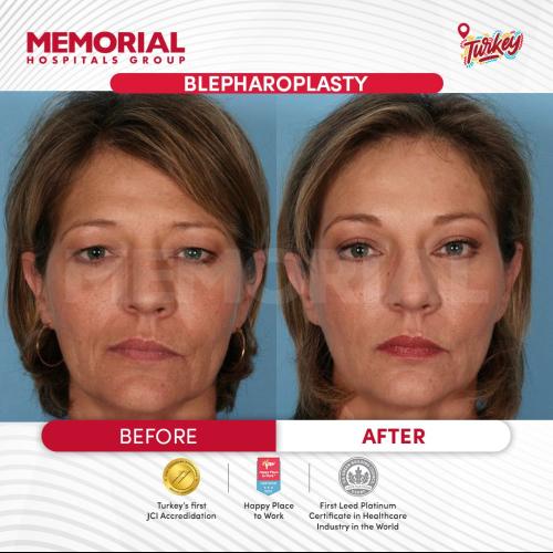 Before after photos of our patients 3