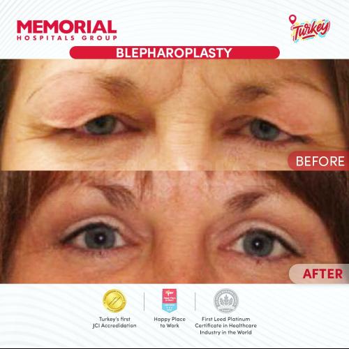 Before after photos of our patients 1