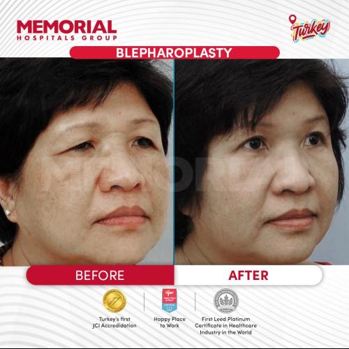 наших пациентов 9