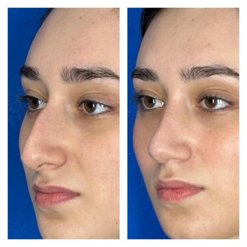 صور قبل وبعد لمرضانا 4