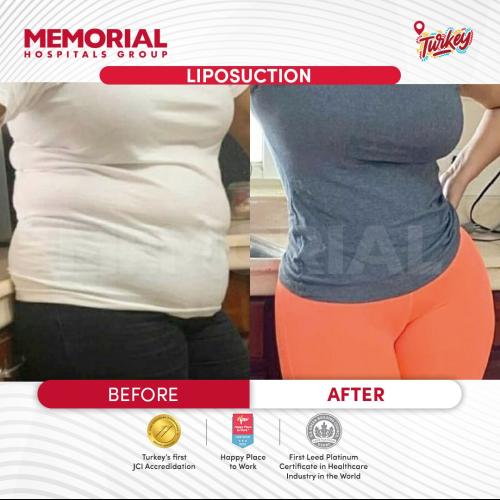 Photos Avant / Après 4