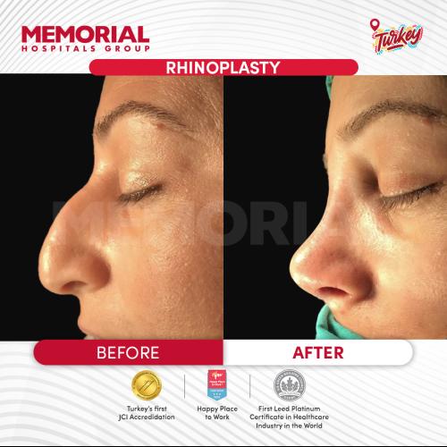 Before after photos of our patients 6