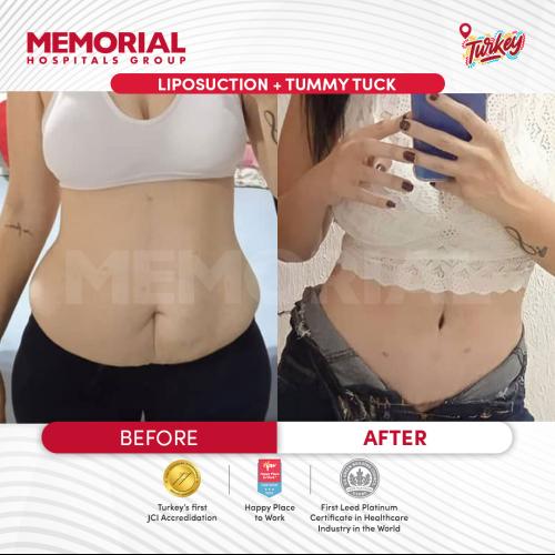 صور قبل وبعد لمرضانا 1