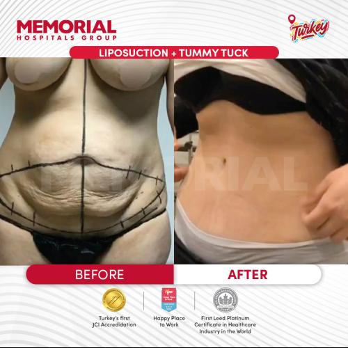 صور قبل وبعد لمرضانا 6