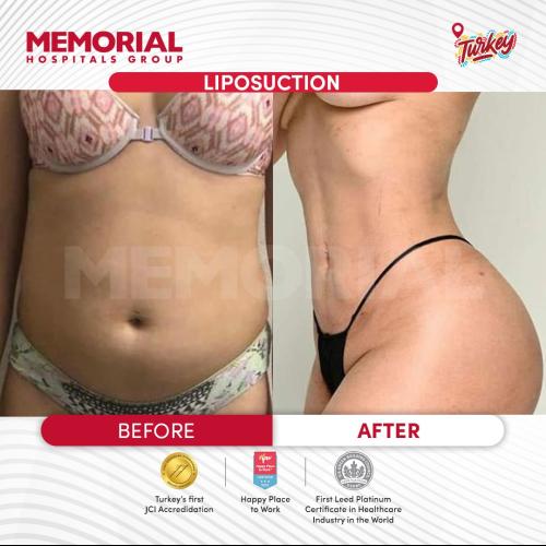 Before after photos of our patients 2