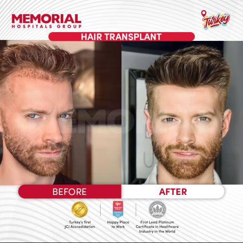 Photos Avant / Après 7