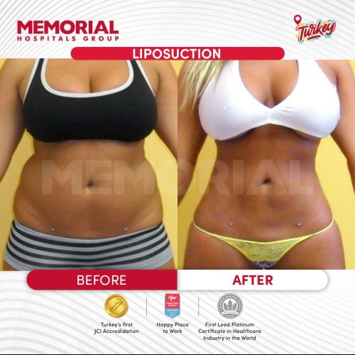 Before after photos of our patients 4