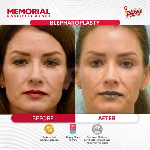 наших пациентов 5