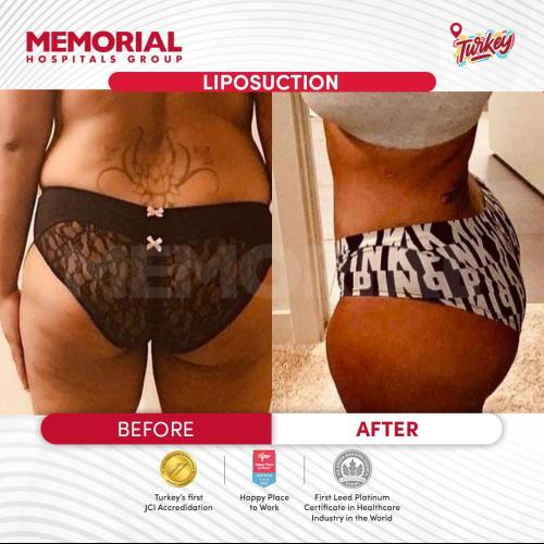 Before after photos of our patients 11