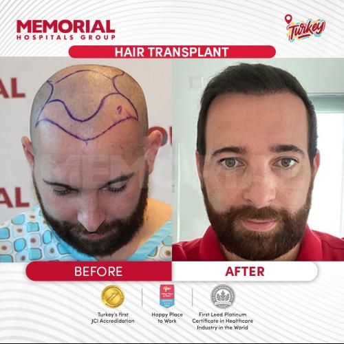 Photos Avant / Après 6