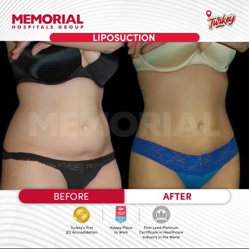 Before after photos of our patients 3