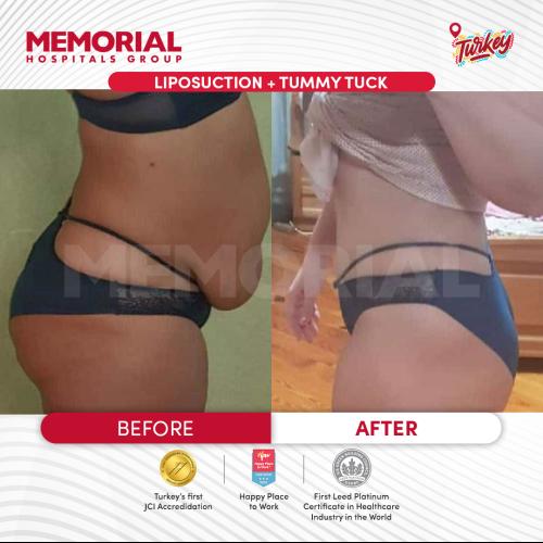 صور قبل وبعد لمرضانا 11