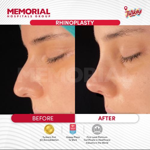 fotos antes y después de nuestros pacientes 6