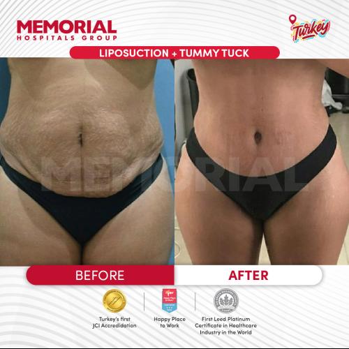 Before after photos of our patients 3