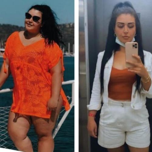 Before after photos of our patients 0