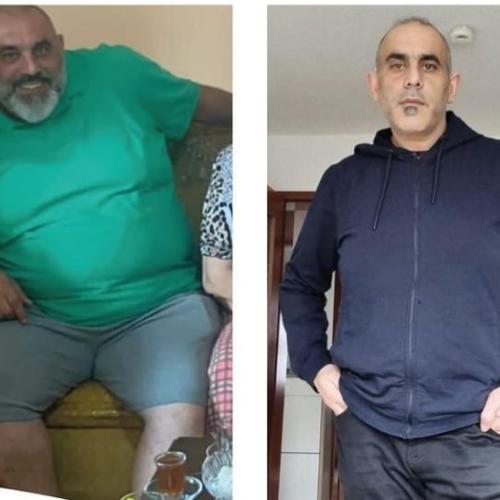 Before after photos of our patients 1