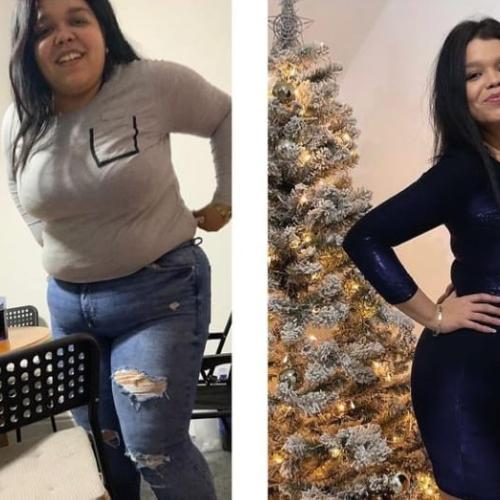 Before after photos of our patients 2