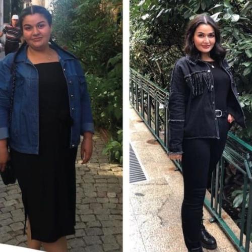 Before after photos of our patients 4