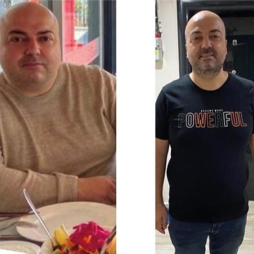 Photos Avant / Après 3