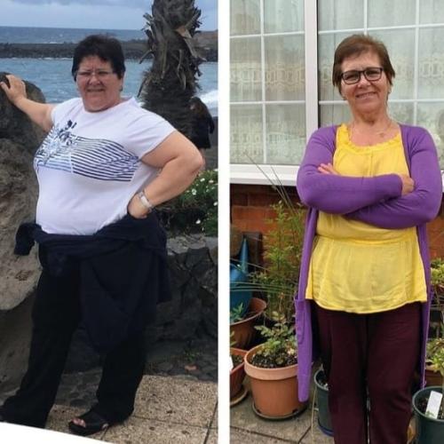 Photos Avant / Après 1