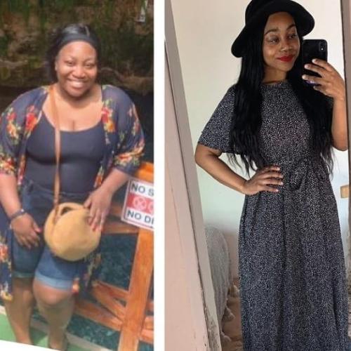 Before after photos of our patients 3