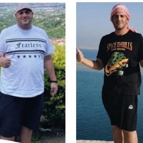 fotos antes y después de nuestros pacientes 11