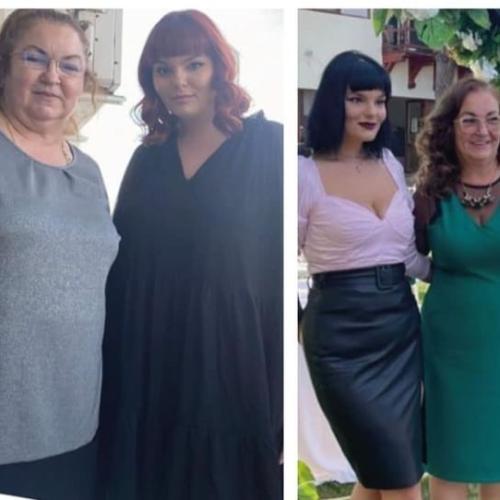 fotos antes y después de nuestros pacientes 0