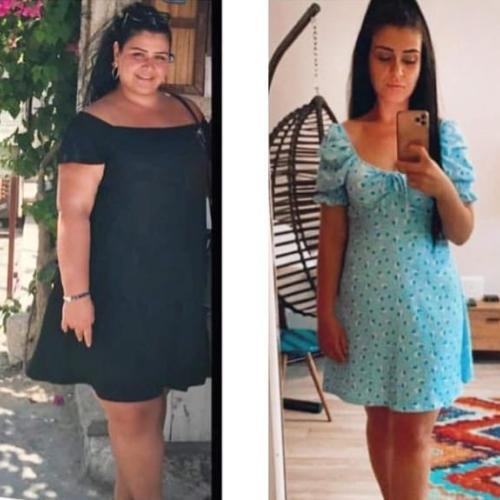 Photos Avant / Après 0