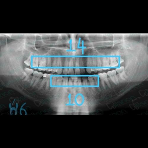 fotos antes y después de nuestros pacientes 6