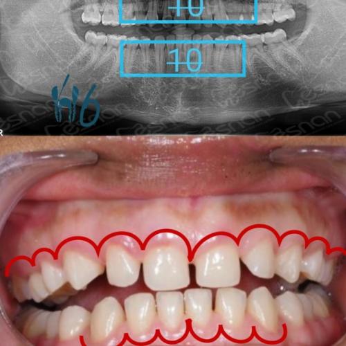 fotos antes y después de nuestros pacientes 0