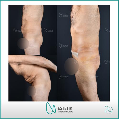Before after photos of our patients 5