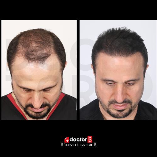 Before after photos of our patients 4