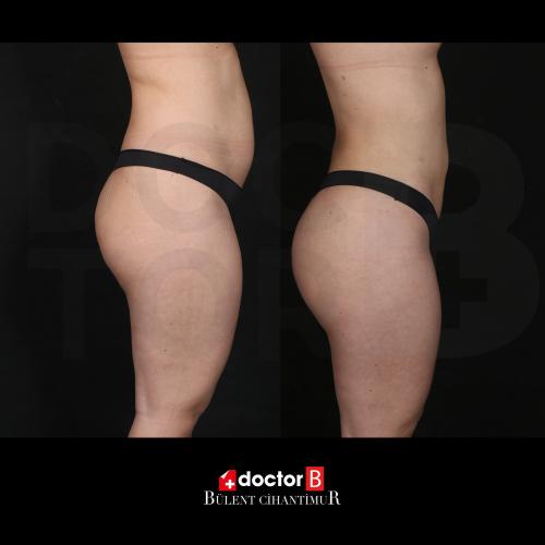 fotos antes y después de nuestros pacientes 8