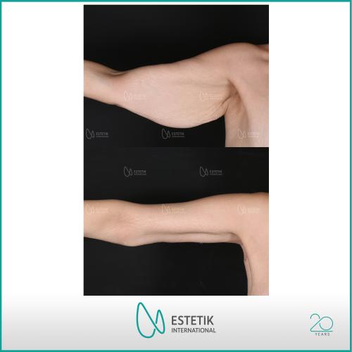 Before after photos of our patients 2