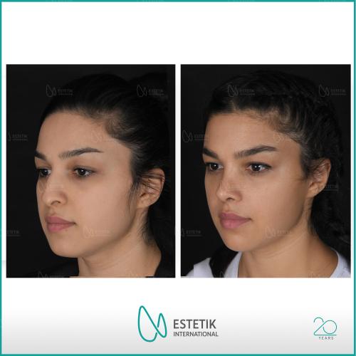 Before after photos of our patients 6