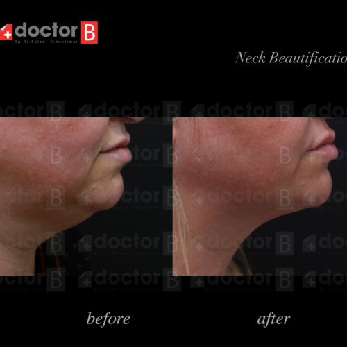 fotos antes y después de nuestros pacientes 10
