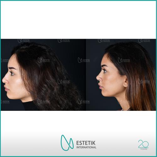 Before after photos of our patients 2