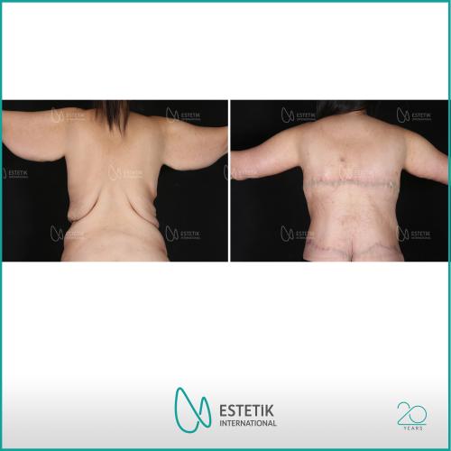 Before after photos of our patients 2